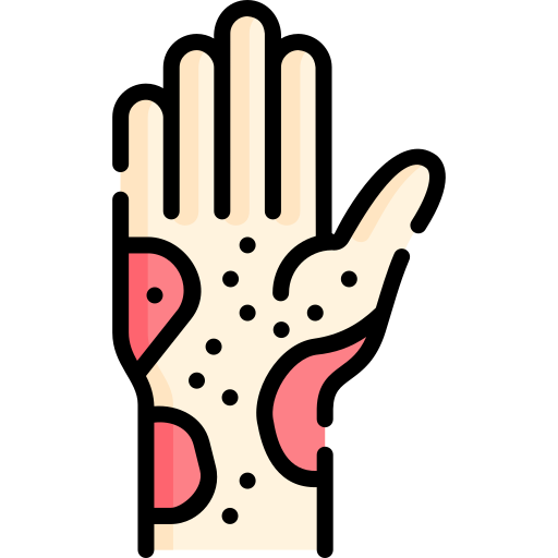 Inflammation